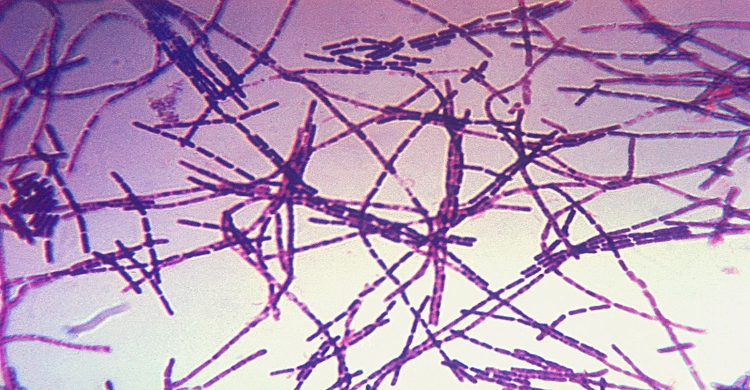 Livestock dept launches urgent, coordinated activities to roll back anthrax